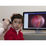 25% OFF Firefly DE550 Wireless Digital Video Otoscope - ONLY 1 AVAILABLE